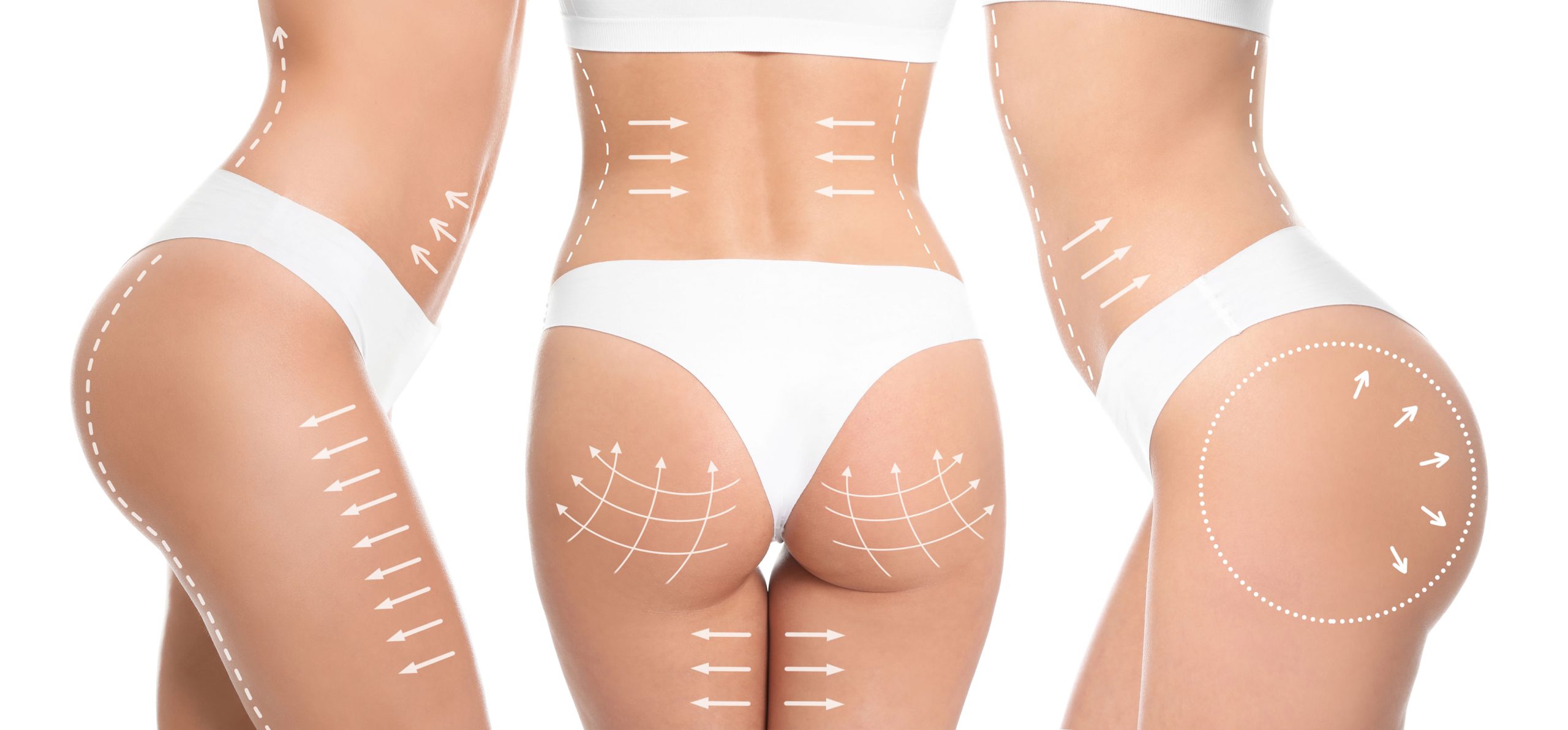 Procedimientos de contorno corporal