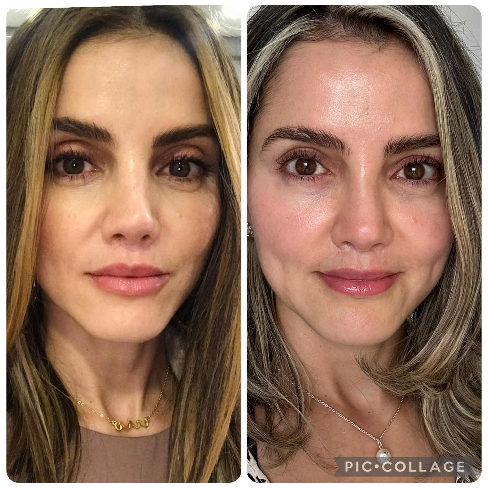 Atención profesional Hannell