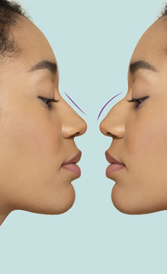 Planeación de cirugía facial